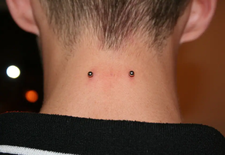 Piercing de superficie en la nuca, con dos puntos de joyería visibles